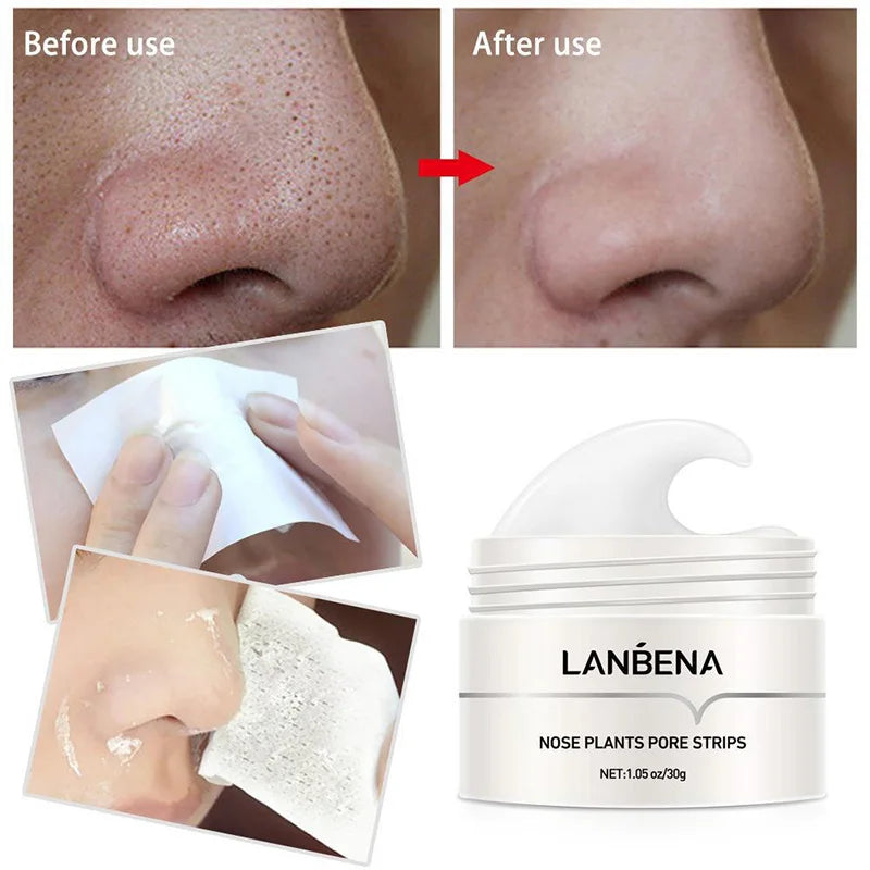 anti blackhead mask